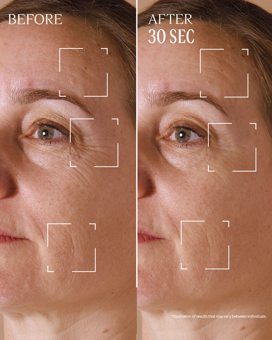 view 7/9 of Immortelle Divine Targeted Wrinkle Care, , SGRECT
